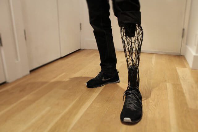 exo 3 printed leg prosthesis in action
