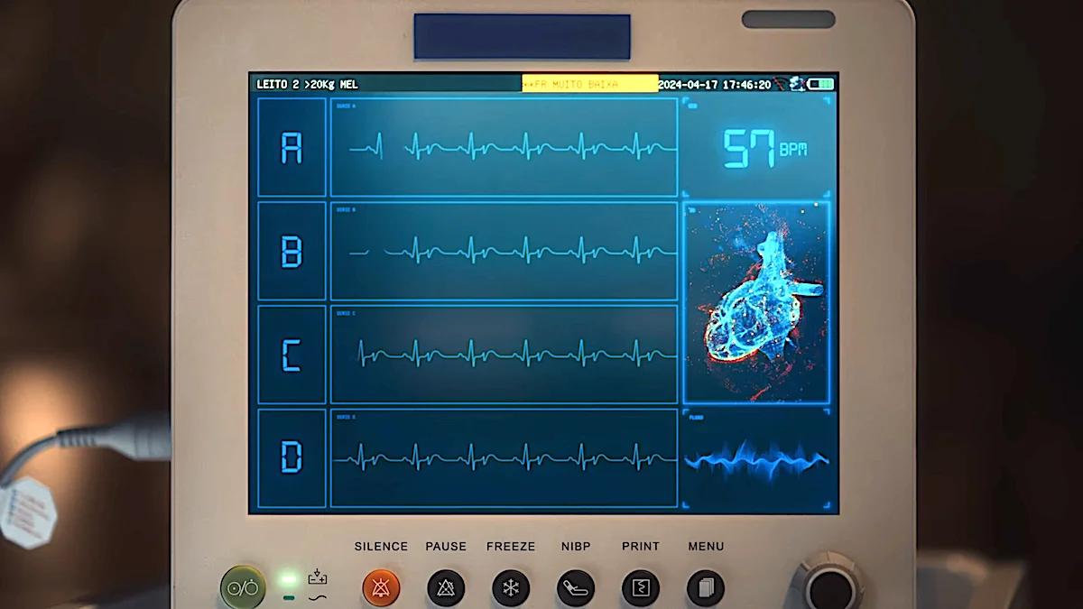 Patient heart rate monitor displaying ECG traces and a 3D heart animation with vital signs stats